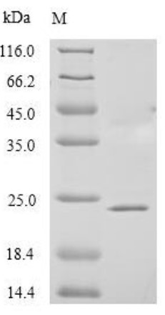 SDS-PAGE (PAEP-5048H).jpg